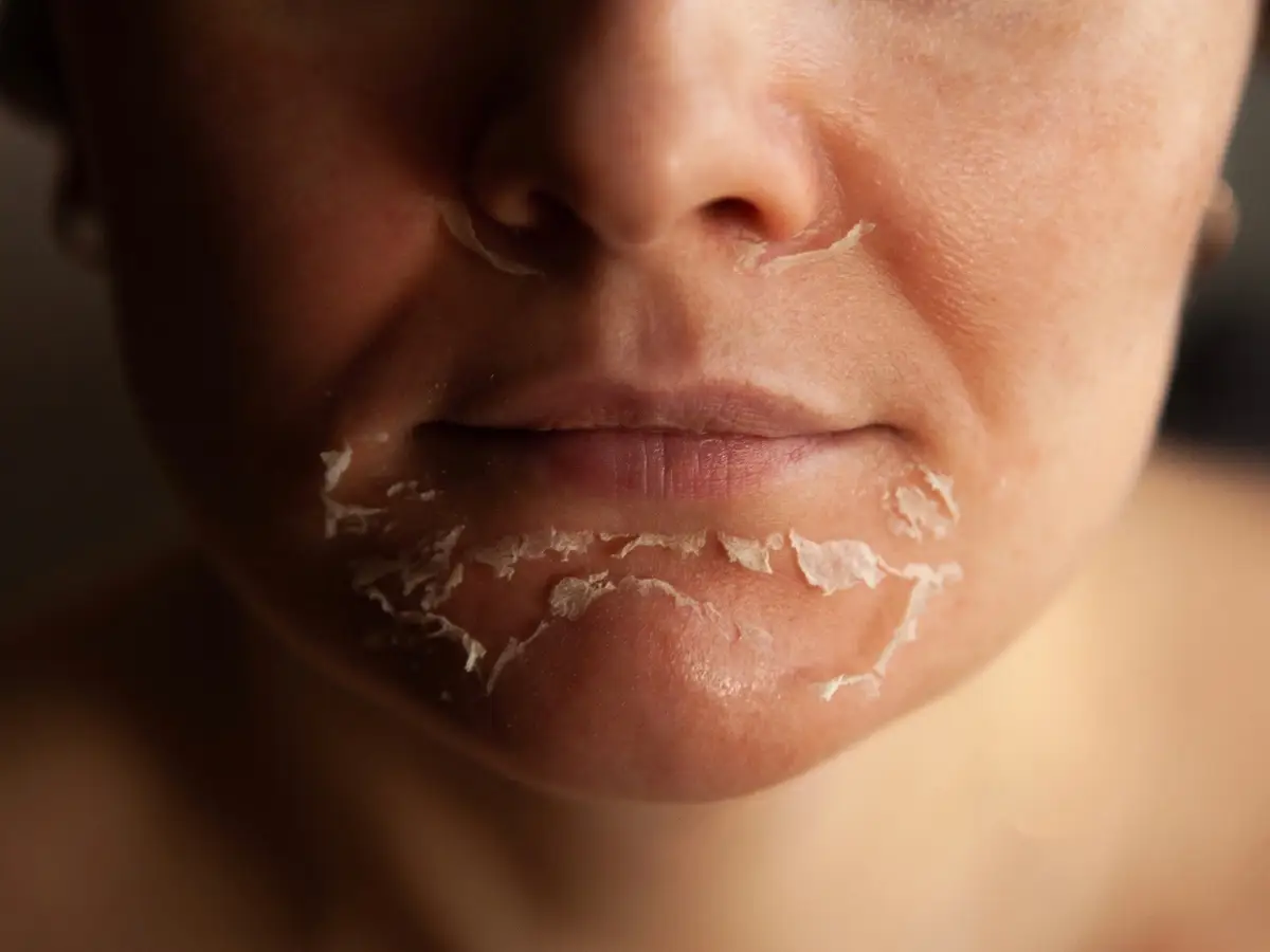 Skincare